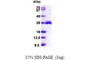MOB1, Mps One Binder Kinase Activator-Like 1B (MOBKL1B) (AA 1-216) protein (His tag)