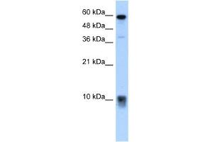 WB Suggested Anti-S100A3 Antibody Titration:  5. (S100A3 抗体  (N-Term))