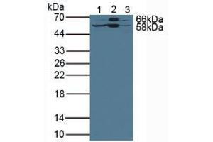 Western blot analysis of (1) Rat Liver Tissue, (2) Mouse Liver Tissue and (3) Human HepG2 Cells. (LSR 抗体  (AA 35-205))