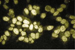 Immunofluorescent staining of HeLa cells. (RIPK2 抗体  (AA 333-532))