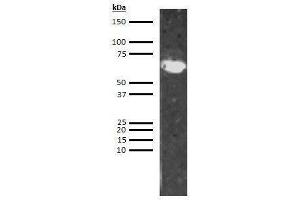 Western Blotting (WB) image for anti-Low Molecular Weight Kininogen (LMWK) antibody (Biotin) (ABIN613239) (LMW Kininogen 抗体  (Biotin))