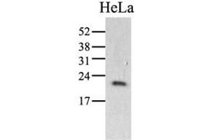 The HeLa (40ug) were resolved by SDS-PAGE, transferred to PVDF membrane and probed with anti-human PPIC antibody (1:1000). (PPIC 抗体)