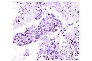 IHC analysis of HAUSP/USP7 using anti-HAUSP/USP7 antibody (ABIN6719603).
