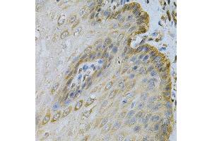 Immunohistochemistry of paraffin-embedded human esophagus using PGK1 Antibody.