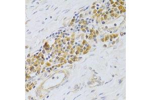 Immunohistochemistry of paraffin-embedded human esophagus using PA2G4 Antibody.