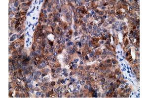 Immunohistochemical staining of paraffin-embedded Human colon tissue using anti-EPHX2 mouse monoclonal antibody. (EPHX2 抗体)