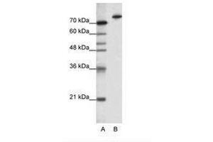 Image no. 1 for anti-Kelch-Like 3 (KLHL3) (N-Term) antibody (ABIN202791) (KLHL3 抗体  (N-Term))