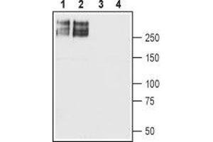 Western blot analysis of rat brain (lanes 1 and 3) and mouse brain (lanes 2 and 4) membranes: - 1,2. (SCN2A 抗体  (Intracellular))