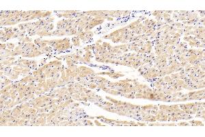 Detection of TNKS2 in Human Cardiac Muscle Tissue using Polyclonal Antibody to Tankyrase 2 (TNKS2) (TNKS2 抗体)