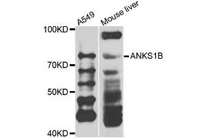 Western blot analysis of extracts of A549 and mouse liver cells, using ANKS1B antibody. (ANKS1B 抗体)