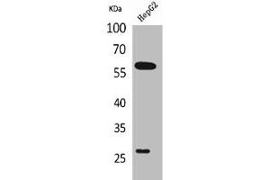Western Blot analysis of HepG2 cells using GGT1 Polyclonal Antibody (GGT1 抗体  (N-Term))