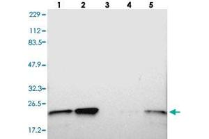 Western blot analysis of Lane 1: RT-4, Lane 2: U-251 MG, Lane 3: Human Plasma, Lane 4: Liver, Lane 5: Tonsil with TAGLN2 polyclonal antibody  at 1:250-1:500 dilution. (TAGLN2 抗体)
