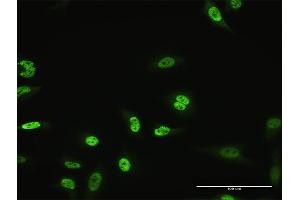 Immunofluorescence of monoclonal antibody to MZF1 on HeLa cell. (MZF1 抗体  (AA 419-518))