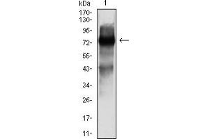 Western Blotting (WB) image for anti-SRY (Sex Determining Region Y)-Box 11 (SOX11) (AA 1-250) antibody (ABIN7193570)
