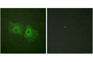 Immunofluorescence analysis of HeLa cells, using Keratin 18 (Ab-33) Antibody. (Cytokeratin 18 抗体  (AA 1-50))