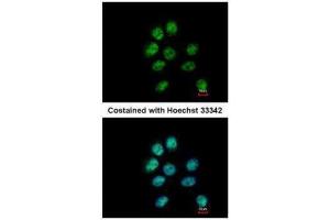 ICC/IF Image Immunofluorescence analysis of paraformaldehyde-fixed A431, using ZNF143, antibody at 1:500 dilution. (ZNF143 抗体  (C-Term))