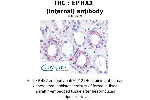 Image no. 1 for anti-Epoxide Hydrolase 2, Cytoplasmic (EPHX2) (Internal Region) antibody (ABIN1734089) (EPHX2 抗体  (Internal Region))