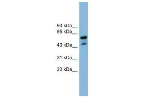 PPME1 antibody used at 1 ug/ml to detect target protein. (PPME1 抗体  (N-Term))