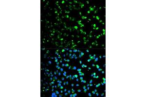Immunofluorescence (IF) image for anti-Thymidine Phosphorylase (TYMP) (AA 1-200) antibody (ABIN3021421)