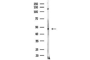 anti-Abhydrolase Domain Containing 12 (ABHD12) antibody