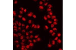 IF analysis of WAPL/FOE using anti-WAPL/FOE antibody (ABIN7602663).