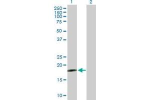 Western Blot analysis of DNAJC5G expression in transfected 293T cell line by DNAJC5G MaxPab polyclonal antibody. (DNAJC5G 抗体  (AA 1-189))