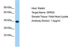 Image no. 1 for anti-G Protein-Coupled Receptor 25 (GPR25) (C-Term) antibody (ABIN6750184)