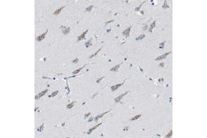 Immunohistochemical staining of human hippocampus with WBSCR17 polyclonal antibody  shows moderate cytoplasmic positivity in neuronal cells. (WBSCR17 抗体)