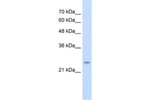 Western Blotting (WB) image for anti-Cysteine-Rich Hydrophobic Domain 1 (CHIC1) antibody (ABIN2463993) (CHIC1 抗体)
