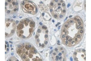 Immunohistochemistry (IHC) image for anti-Glyceraldehyde-3-Phosphate Dehydrogenase (GAPDH) (AA 2-148) antibody (ABIN7426391)