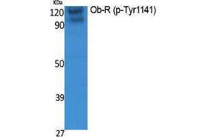 Western Blotting (WB) image for anti-Leptin Receptor (LEPR) (pTyr1141) antibody (ABIN3183068) (Leptin Receptor 抗体  (pTyr1141))
