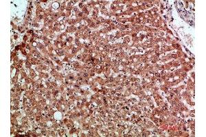 Immunohistochemical analysis of paraffin-embedded human-liver, antibody was diluted at 1:200 (CCL2 抗体  (AA 31-80))