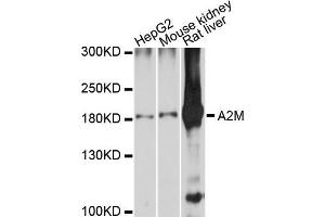 Western blot analysis of extracts of various cell lines, using A2M antibody. (alpha 2 Macroglobulin 抗体)