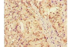 Immunohistochemistry of paraffin-embedded human adrenal gland tissue using ABIN7150120 at dilution of 1:100 (ZRANB3 抗体  (AA 370-624))