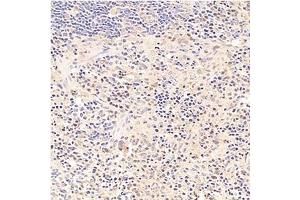 Immunohistochemistry analysis of paraffin-embedded rat spleen using,Tal1 (ABIN7075819) at dilution of 1: 1500 (TAL1 抗体)