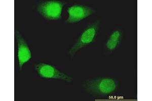Immunofluorescence of monoclonal antibody to FOXO1 on HeLa cell. (FOXO1 抗体  (AA 452-555))