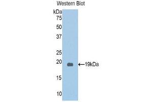Western Blotting (WB) image for anti-Protein Kinase N2 (PKN2) (AA 323-464) antibody (ABIN1860246) (PKN2 抗体  (AA 323-464))