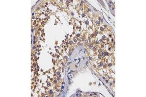 staining BPC3 in human testis tissue sections by Immunohistochemistry (IHC-P - raformaldehyde-fixed, raffin-embedded sections). (PABPC3 抗体  (AA 84-117))