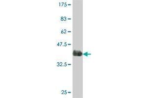 Western Blot detection against Immunogen (37. (MLKL 抗体  (AA 371-471))