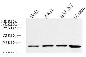 Western Blot analysis of various samples using CK-17 Polyclonal Antibody at dilution of 1:600. (KRT17 抗体)