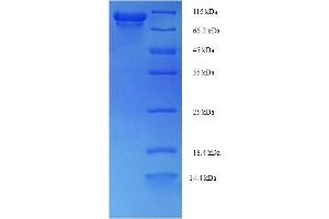SDS-PAGE (SDS) image for Precursor of Prostate Specific Antigen (proPSA) (AA 2-792) protein (His-SUMO Tag) (ABIN5710874)