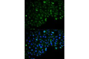 Immunofluorescence analysis of U2OS cells using HK2 antibody. (Hexokinase 2 抗体)