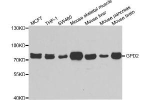 Western blot analysis of extracts of various cell lines, using GPD2 antibody. (GPD2 抗体)