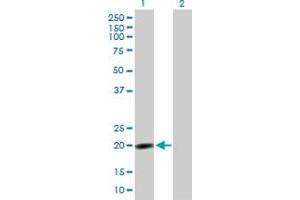 Western Blot analysis of NPM3 expression in transfected 293T cell line by NPM3 MaxPab polyclonal antibody. (NPM3 抗体  (AA 1-178))