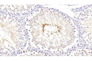 Detection of RLN in Rat Testis Tissue using Polyclonal Antibody to Relaxin (RLN) (Relaxin 抗体  (AA 23-186))