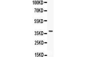 Anti- HEXB antibody, Western blotting All lanes: Anti HEXB  at 0. (HEXB 抗体  (AA 381-556))