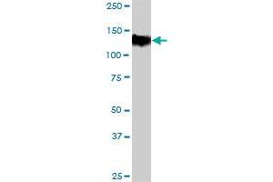 TPO MaxPab rabbit polyclonal antibody. (Thyroperoxidase 抗体  (AA 1-933))