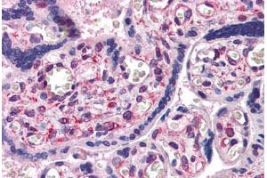 anti-SUMO1 Activating Enzyme Subunit 1 (SAE1) (AA 1-347) antibody