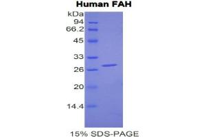 SDS-PAGE analysis of Human FAH Protein. (FAH 蛋白)