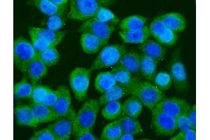 IF analysis of GFPT1 using anti-GFPT1 antibody (ABIN7602887). (GFPT1 抗体  (C-Term))